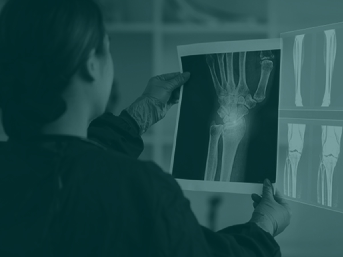 Woman examining x-ray